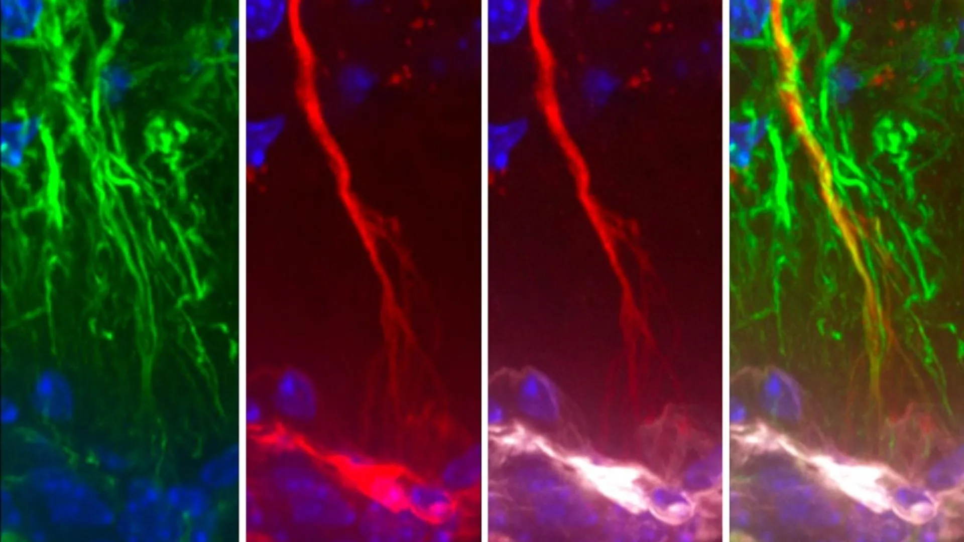 New Study Uncovers Tanycytes’ Crucial Role in Alzheimer’s Disease Pathology