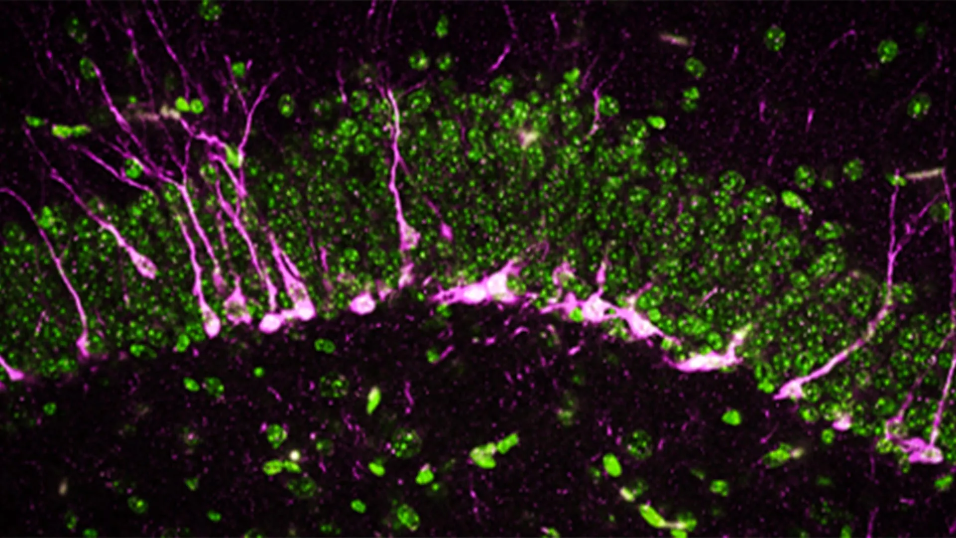 A New Approach to Alzheimer’s Disease Treatment Emerges from Research on a Protein That Produces a Vital Brain Gas