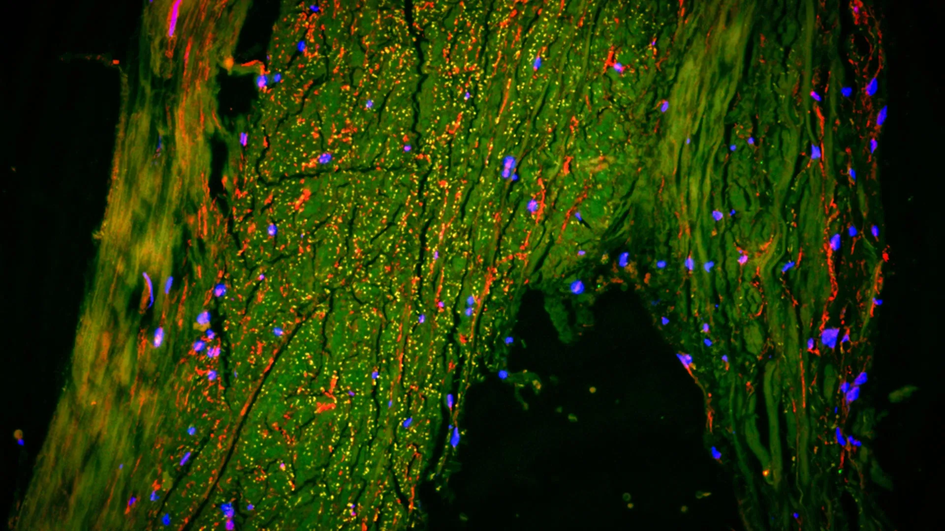 Unveiling the Brain’s Hidden Drainage: Middle Meningeal Artery Identified as Crucial Lymphatic Control Point