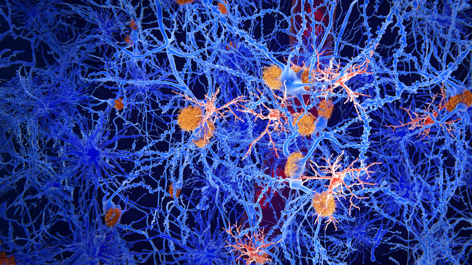 A Promising New Avenue for Alzheimer’s Treatment: Experimental Molecule Reprograms Brain’s Immune Cells to Combat Disease