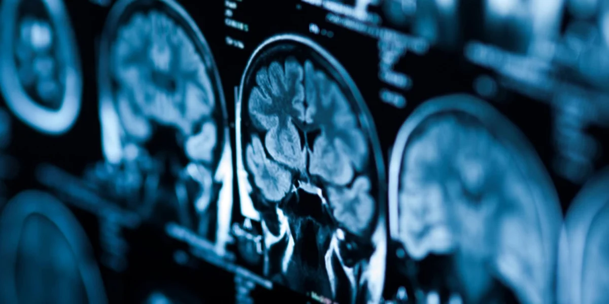Indoor radon exposure linked to altered brain development in youth