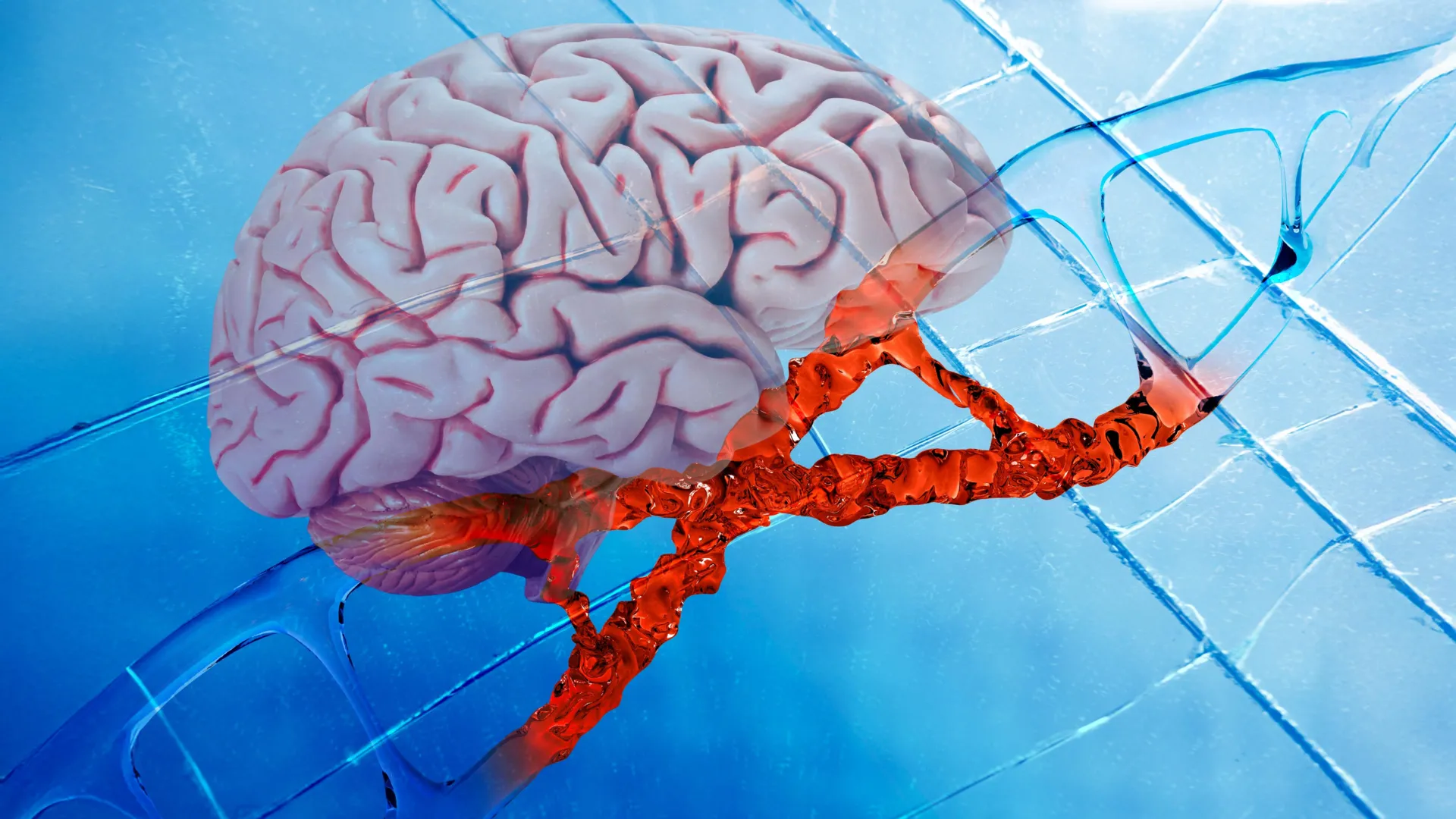 New Alzheimer’s drug repairs DNA damage and reduces brain inflammation