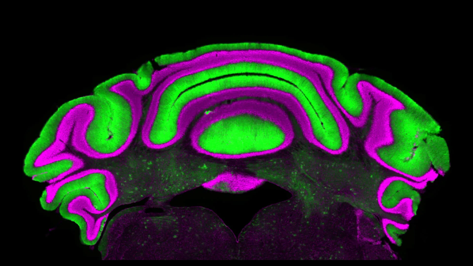 New Research Challenges Long-Held Assumptions in Cerebellar Neuroscience