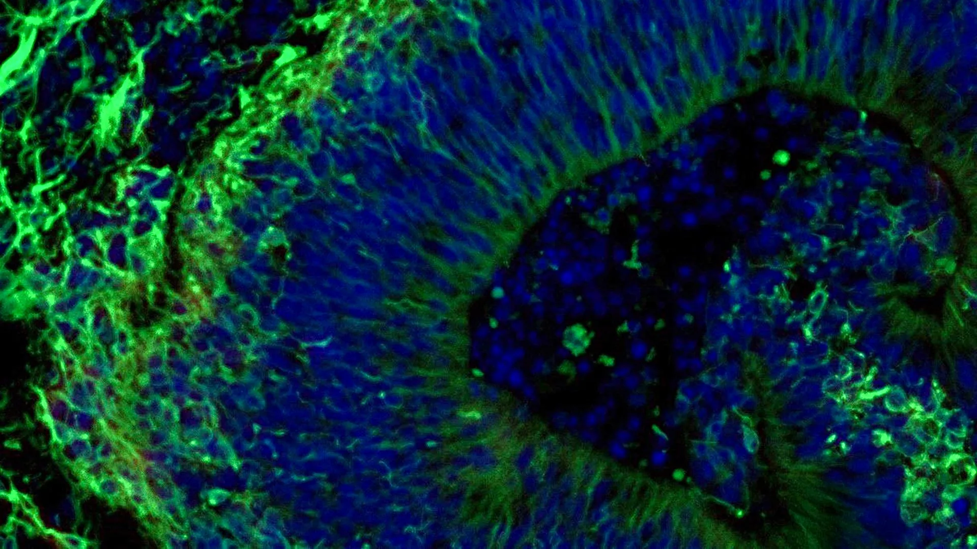 Novel Brain Organoids Show Promise in Predicting Alzheimer’s Drug Response and Guiding Personalized Treatment Strategies
