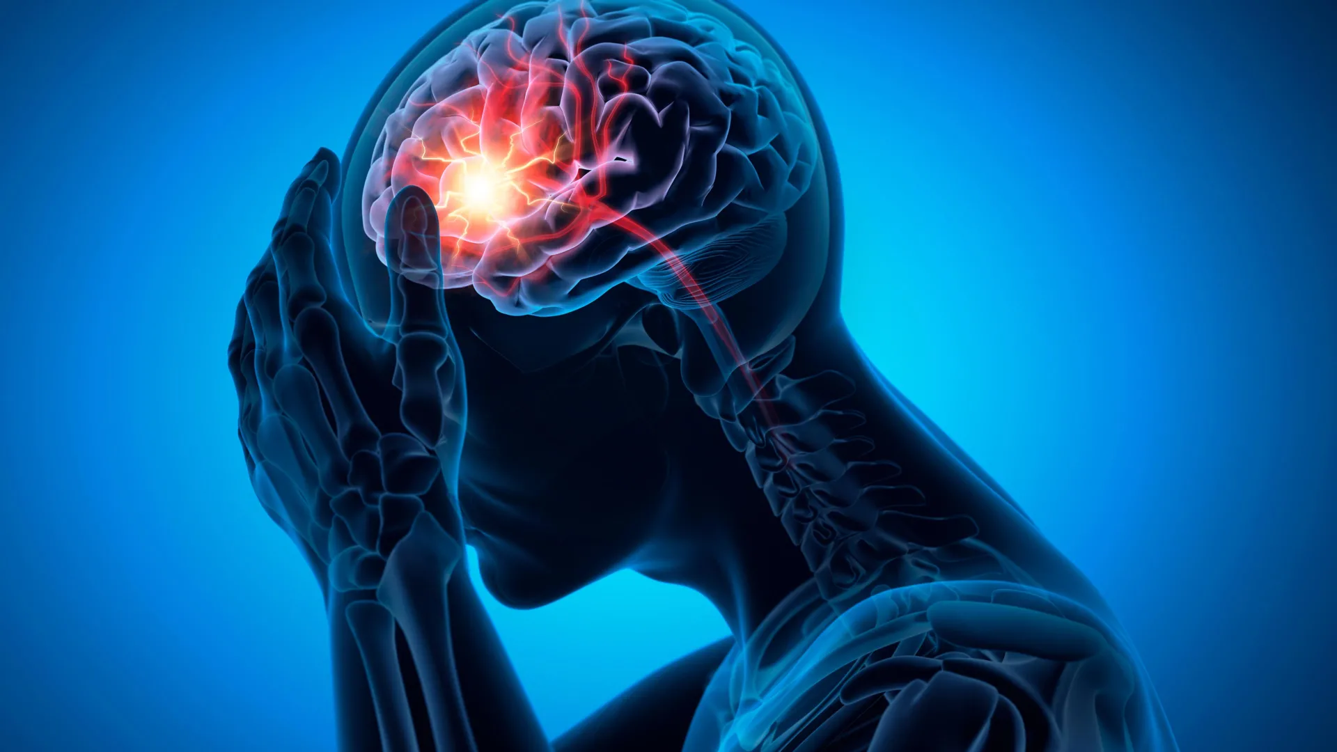 Rethinking Stroke Prevention: New Research Challenges Long-Held Assumptions About Lacunar Strokes