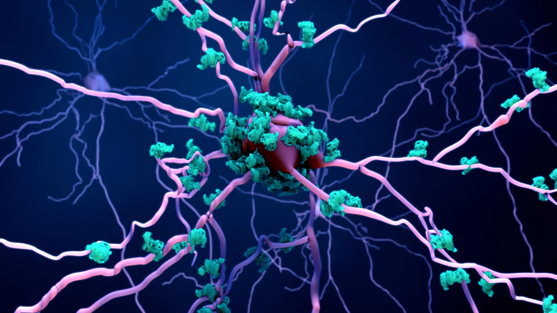 Unveiling Karyoptosis: A Novel Pathway Illuminates Brain Cell Demise in Alzheimer’s and FTD