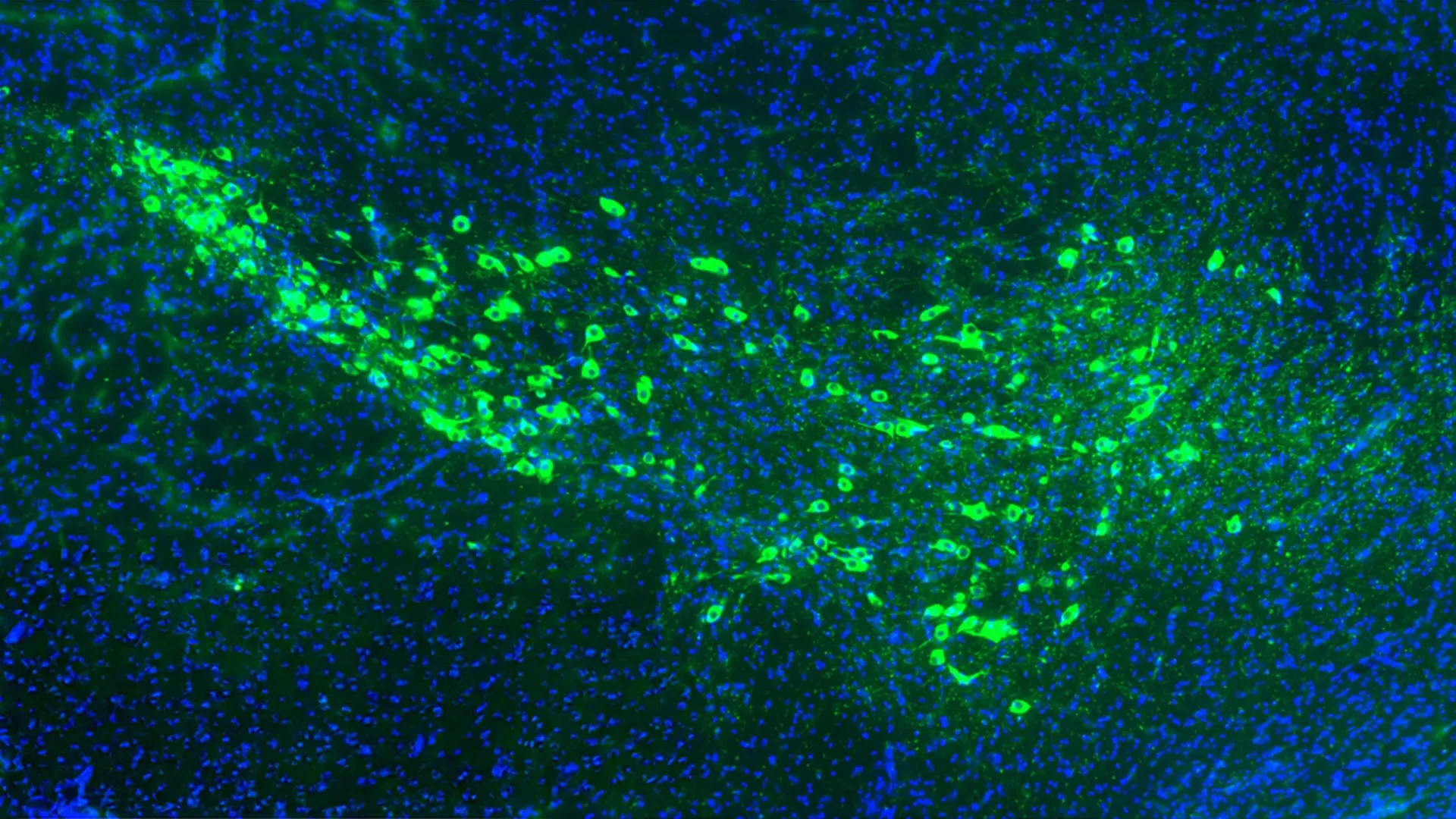 Yale Researchers Uncover Key Proteins Driving Parkinson’s Disease Spread, Offering Hope for New Therapies