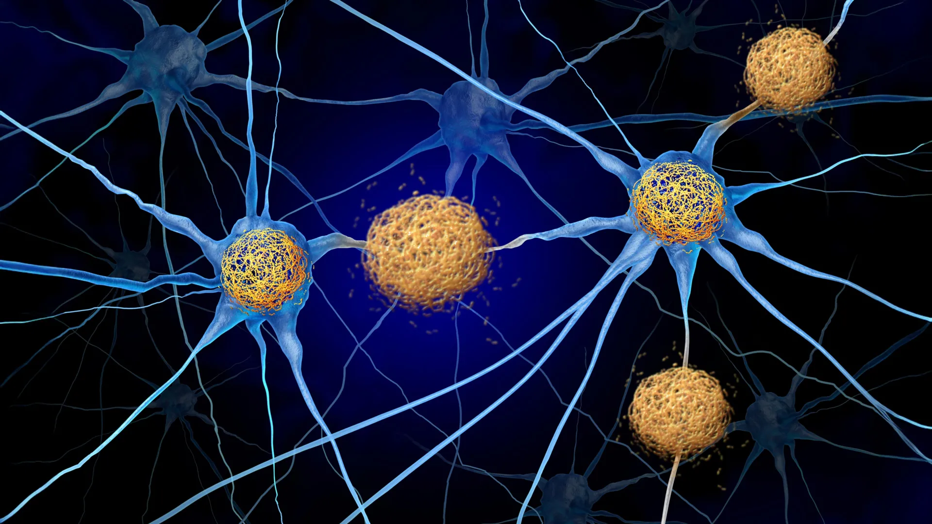 Beyond Amyloid Beta: A New Frontier in Alzheimer’s Disease Research Challenges Decades of Scientific Consensus